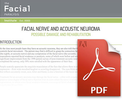 Facial Nerve and Acoustic Neuroma PDF